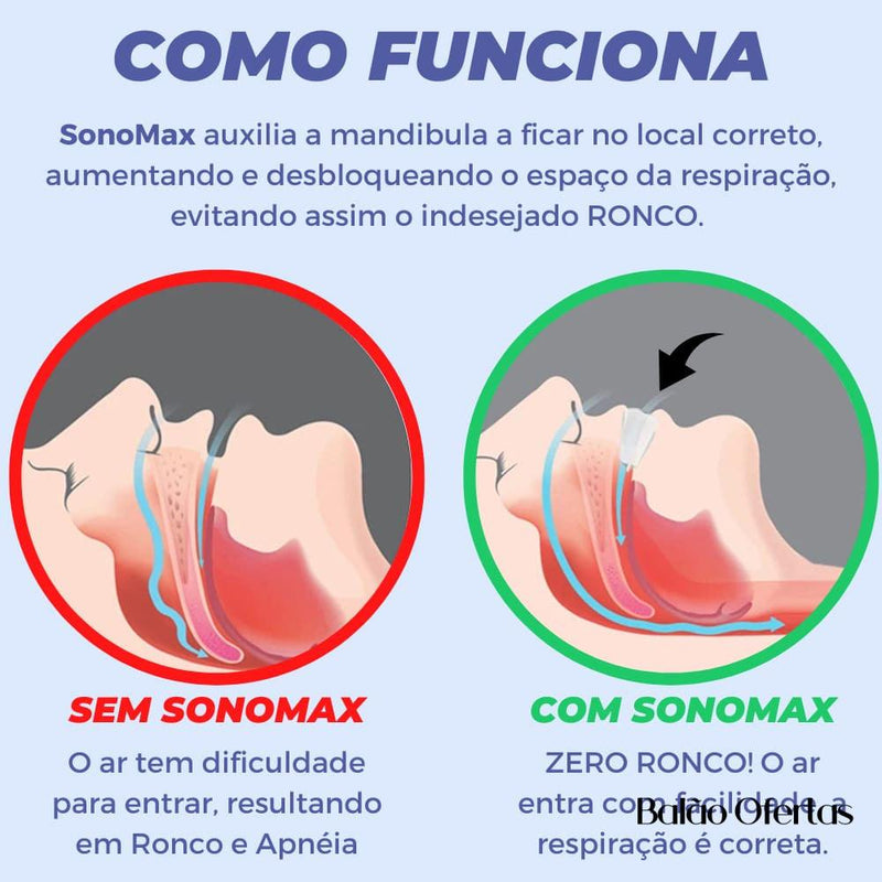 SonoMax - Aparelho Anti Ronco, Bruxismo e Apnéia com Eficácia Imediata